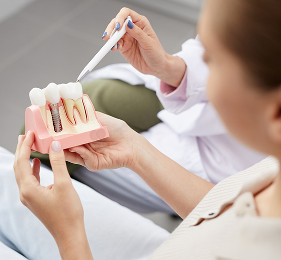 Female dental patient holding a model of dental implant