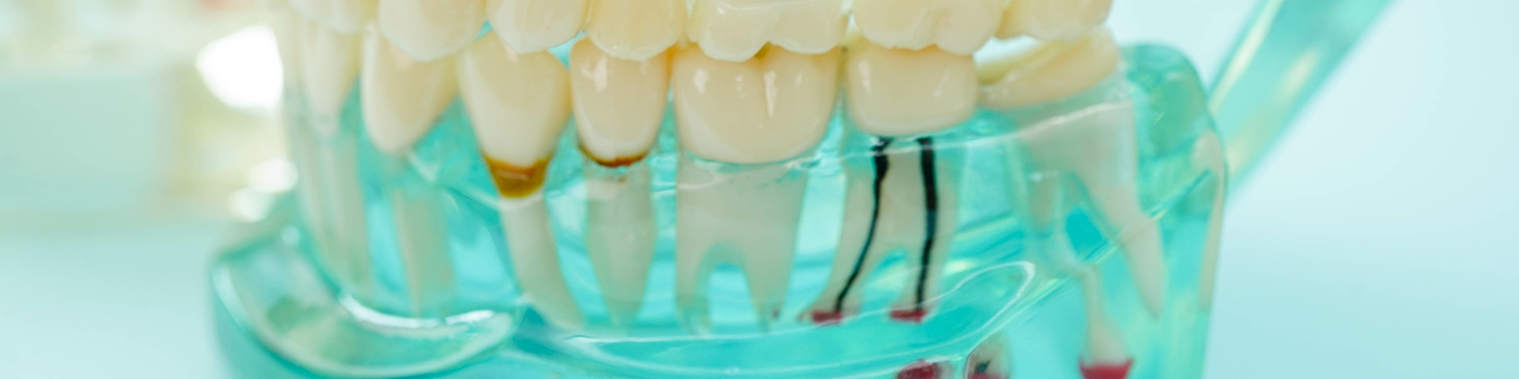 Models of teeth in plastic tray