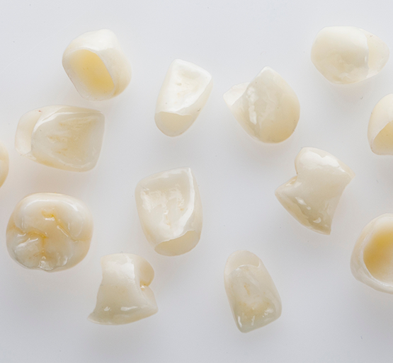 Multiple metal free restorations on white surface