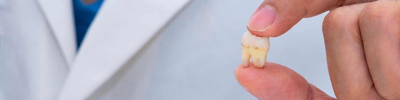 Close-up of tooth held between two fingers
