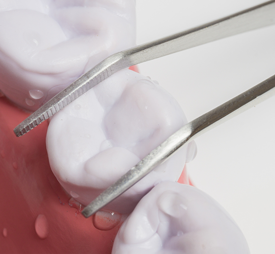 Tooth in lower arch and forceps